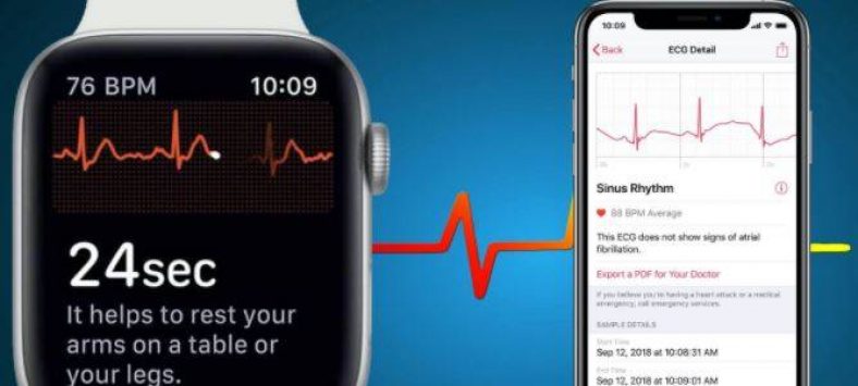 How to share an ECG from Apple Watch with the doctor